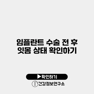 임플란트 수술 전 후 잇몸 상태 확인하기